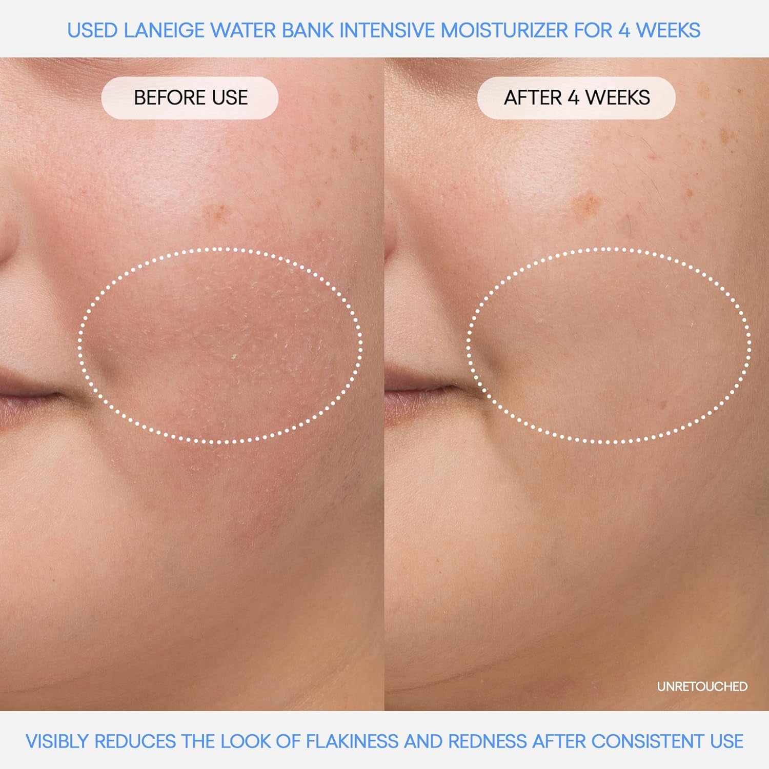 Water Bank Blue Hyaluronic Intensive Moisturizer: Hydrating Face Cream for Extra Dry Skin with Squalane & Peptide for Skin Barrier Support, Dermatologist-Tested